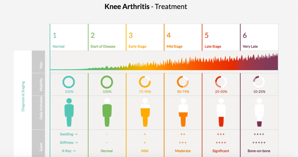 knee arthritis